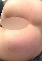 Meine süße Rosette